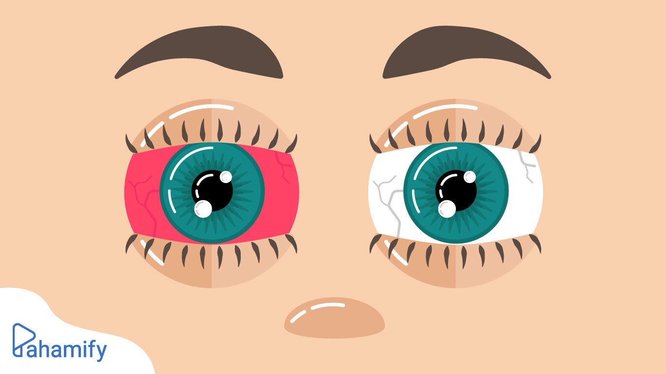 Cara Menjaga Kesehatan Mata selama Belajar Online di Rumah